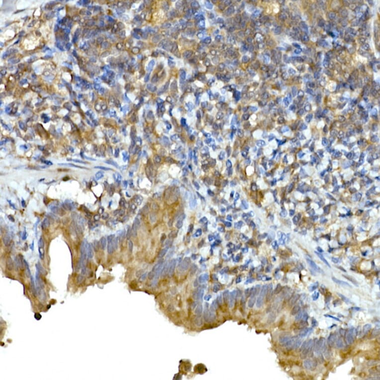 Immunohistochemistry - Anti-MDA5 Antibody (A88241) - Antibodies.com