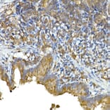 Immunohistochemistry - Anti-MDA5 Antibody (A88241) - Antibodies.com