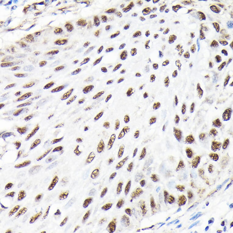 Immunohistochemistry - Anti-CTCF Antibody (A88242) - Antibodies.com