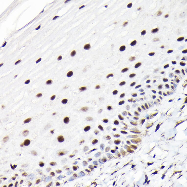 Immunohistochemistry - Anti-CTCF Antibody (A88242) - Antibodies.com