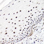 Immunohistochemistry - Anti-CTCF Antibody (A88242) - Antibodies.com