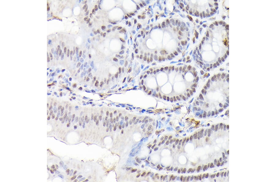 Immunohistochemistry - Anti-CTCF Antibody (A88242) - Antibodies.com