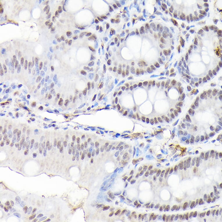 Immunohistochemistry - Anti-CTCF Antibody (A88242) - Antibodies.com