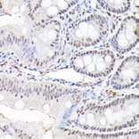 Immunohistochemistry - Anti-CTCF Antibody (A88242) - Antibodies.com