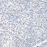 Immunohistochemistry - Anti-CTCF Antibody (A88242) - Antibodies.com