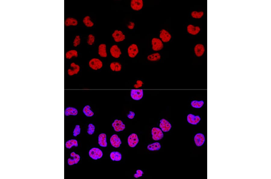 Immunofluorescence - Anti-CTCF Antibody (A88242) - Antibodies.com