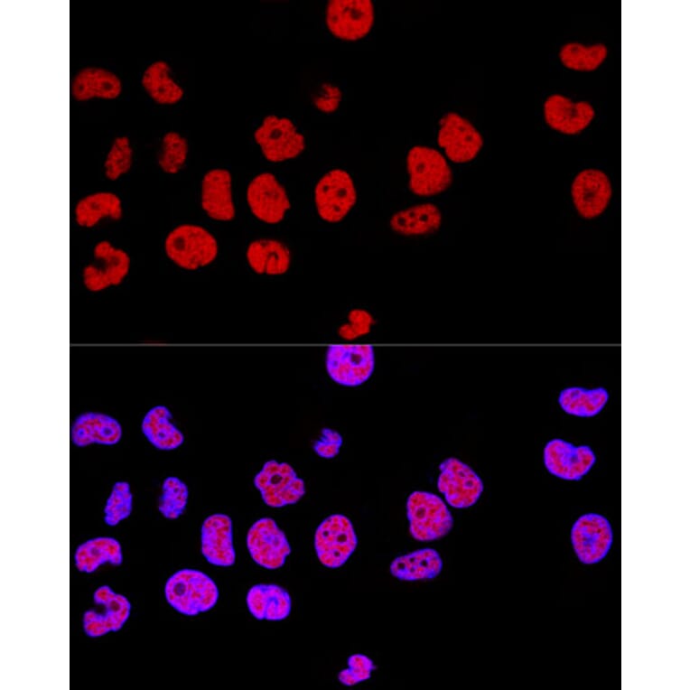 Immunofluorescence - Anti-CTCF Antibody (A88242) - Antibodies.com