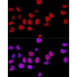 Immunofluorescence - Anti-CTCF Antibody (A88242) - Antibodies.com