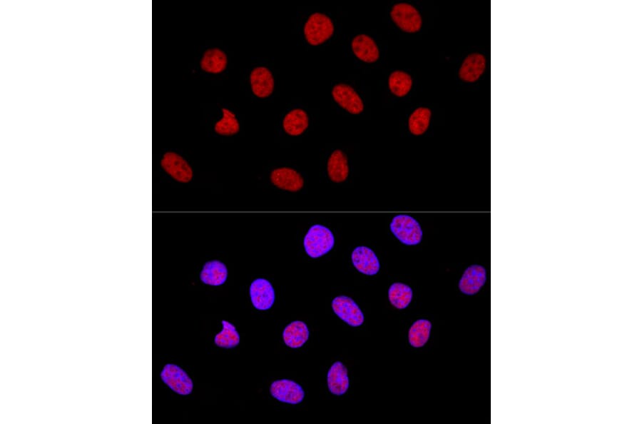 Immunofluorescence - Anti-CTCF Antibody (A88242) - Antibodies.com