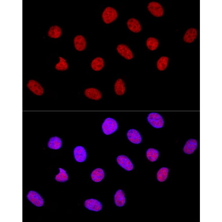 Immunofluorescence - Anti-CTCF Antibody (A88242) - Antibodies.com