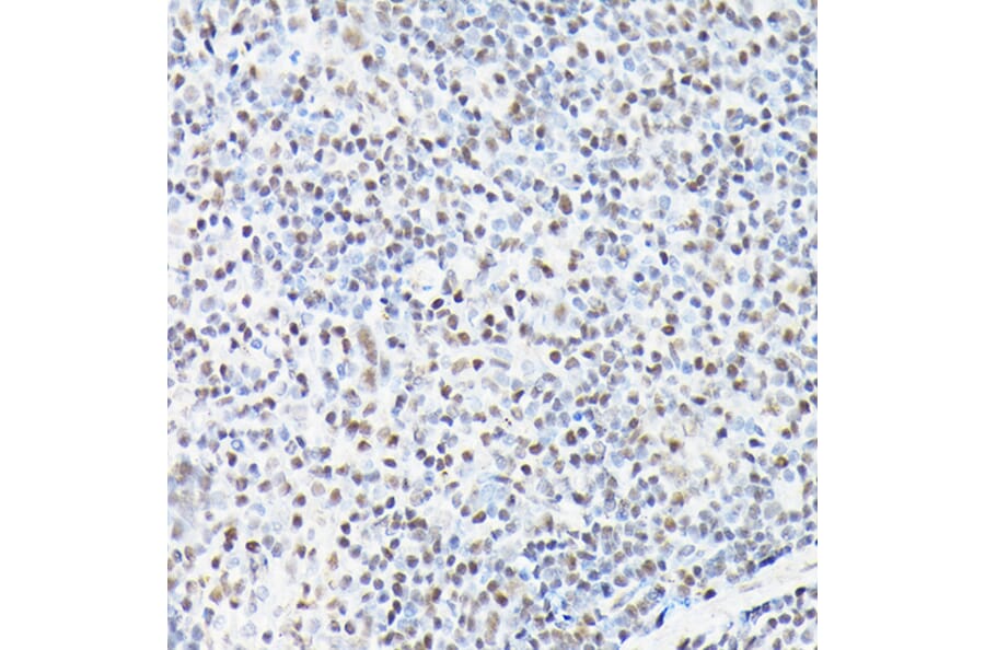 Chromatin Immunoprecipitation - Anti-CTCF Antibody (A88242) - Antibodies.com