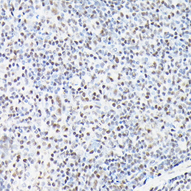 Chromatin Immunoprecipitation - Anti-CTCF Antibody (A88242) - Antibodies.com