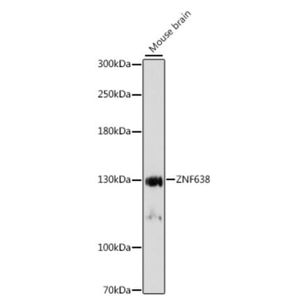 Western Blot - Anti-ZNF638 Antibody (A88243) - Antibodies.com