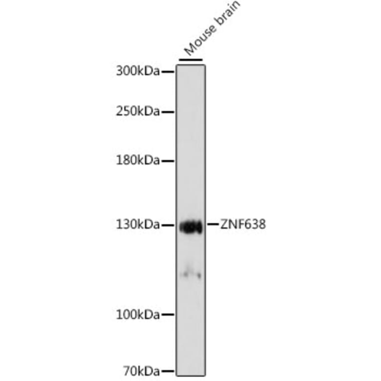 Western Blot - Anti-ZNF638 Antibody (A88243) - Antibodies.com