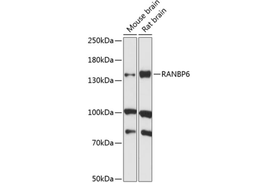 Western Blot - Anti-RANBP6 Antibody (A88244) - Antibodies.com
