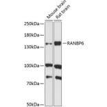 Western Blot - Anti-RANBP6 Antibody (A88244) - Antibodies.com