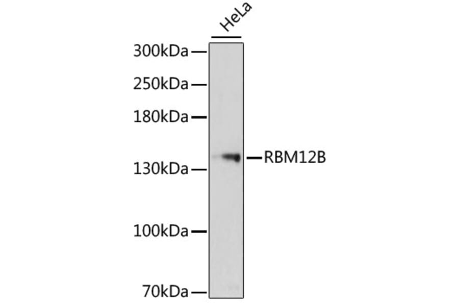 Western Blot - Anti-RBM12B Antibody (A13241) - Antibodies.com