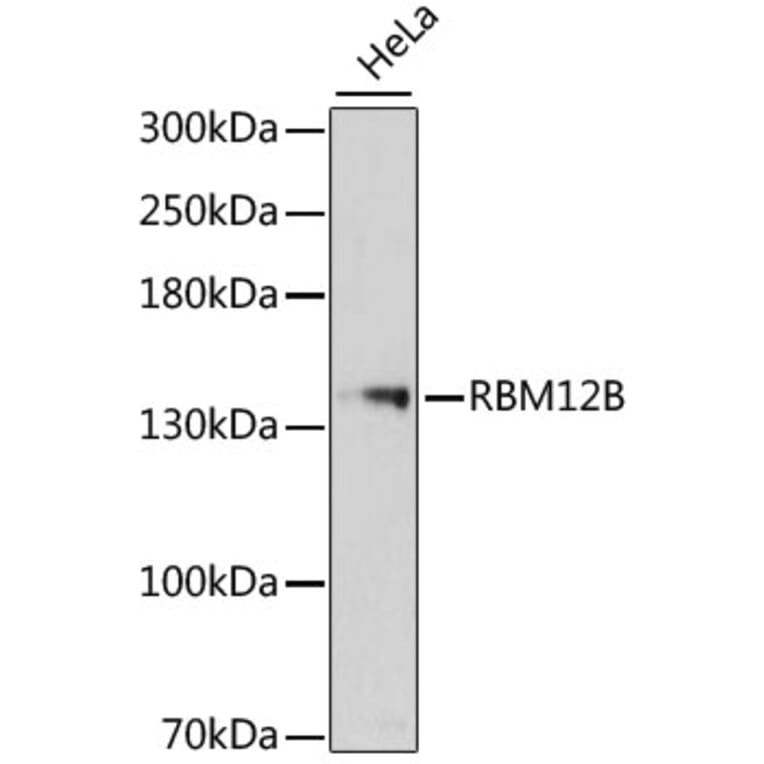 Western Blot - Anti-RBM12B Antibody (A13241) - Antibodies.com
