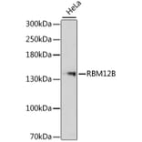 Western Blot - Anti-RBM12B Antibody (A13241) - Antibodies.com