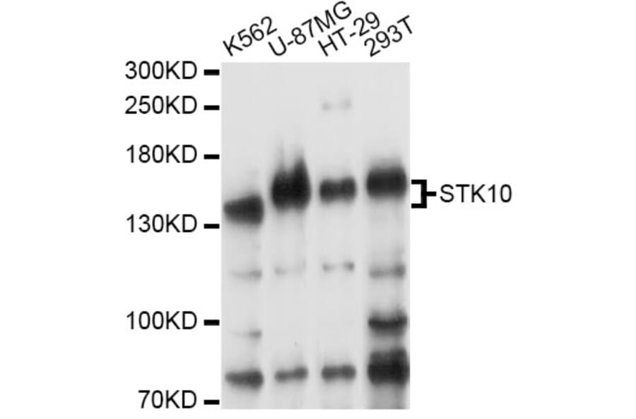 Western Blot - Anti-STK10 Antibody (A14257) - Antibodies.com