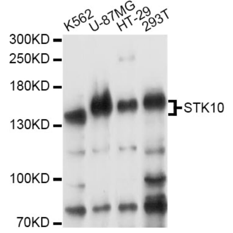 Western Blot - Anti-STK10 Antibody (A14257) - Antibodies.com