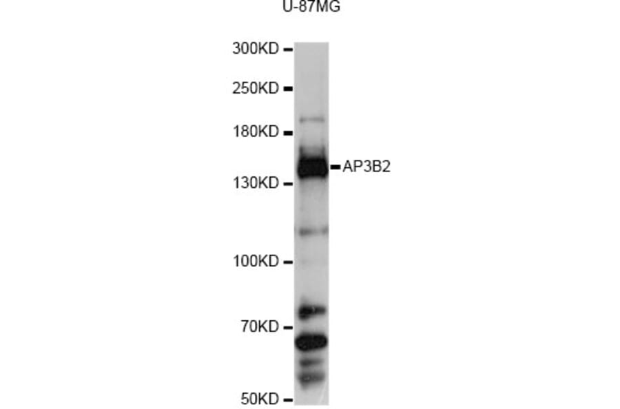 Western Blot - Anti-AP3B2 Antibody (A13809) - Antibodies.com