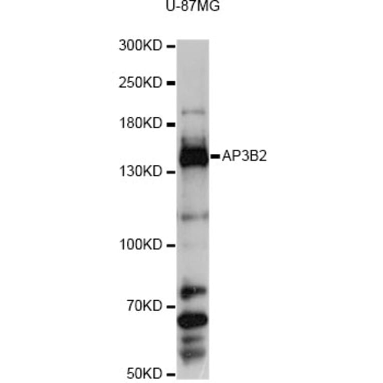 Western Blot - Anti-AP3B2 Antibody (A13809) - Antibodies.com