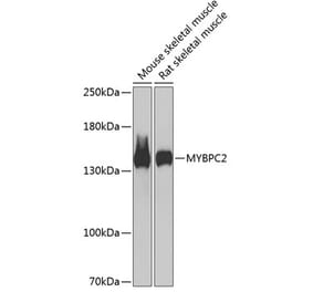 Western Blot - Anti-fast skeletal Myosin Antibody (A88250) - Antibodies.com
