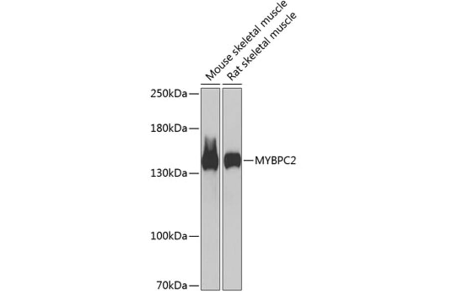 Western Blot - Anti-fast skeletal Myosin Antibody (A88250) - Antibodies.com