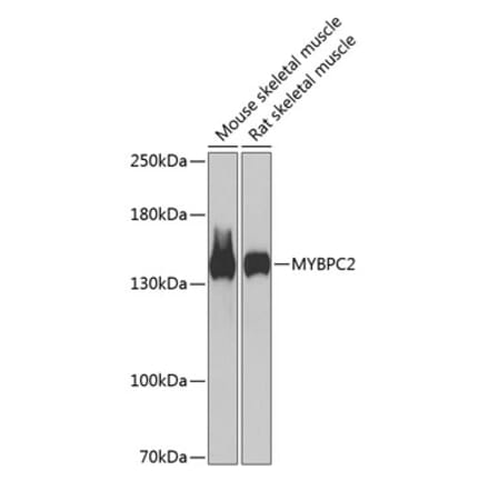 Western Blot - Anti-fast skeletal Myosin Antibody (A88250) - Antibodies.com