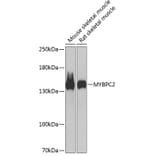 Western Blot - Anti-fast skeletal Myosin Antibody (A88250) - Antibodies.com