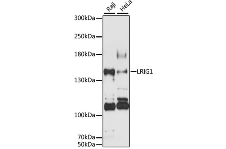 Western Blot - Anti-LRIG1 Antibody (A12027) - Antibodies.com