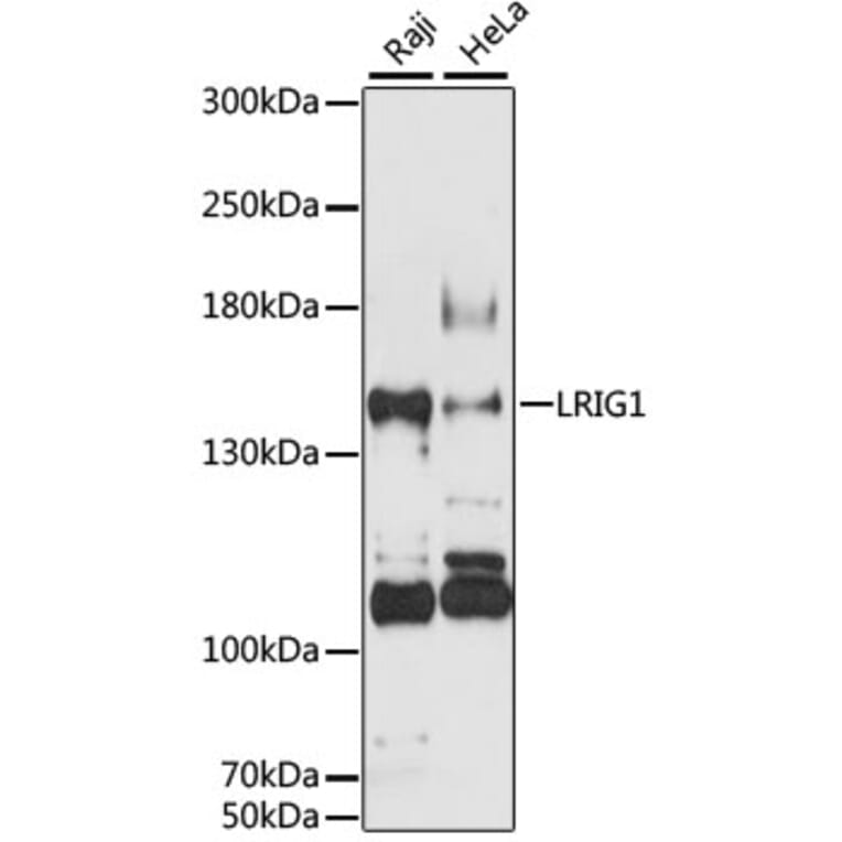 Western Blot - Anti-LRIG1 Antibody (A12027) - Antibodies.com