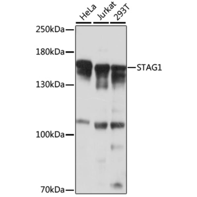 Western Blot - Anti-STAG1 Antibody (A17315) - Antibodies.com