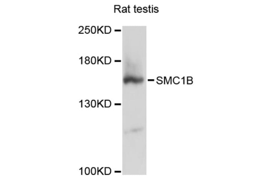 Western Blot - Anti-SMC1B Antibody (A12905) - Antibodies.com