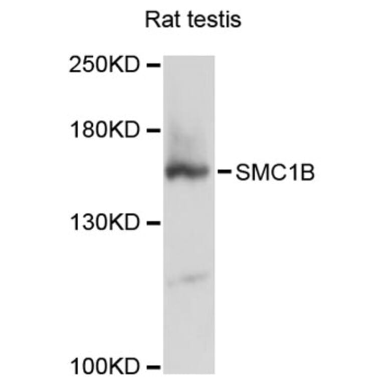 Western Blot - Anti-SMC1B Antibody (A12905) - Antibodies.com
