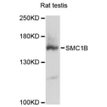 Western Blot - Anti-SMC1B Antibody (A12905) - Antibodies.com