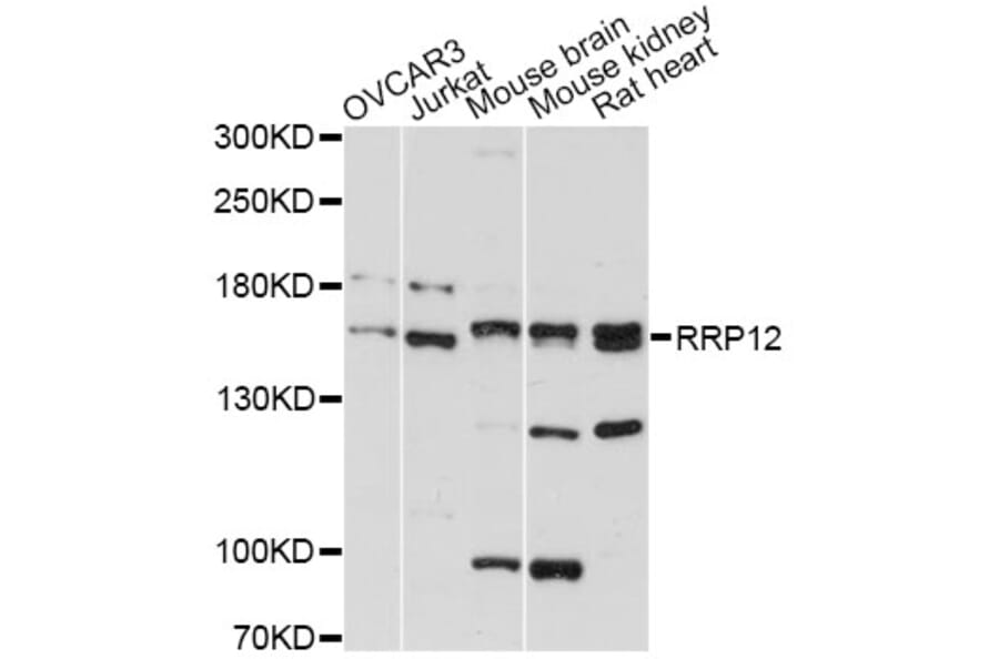 Western Blot - Anti-RRP12 Antibody (A13257) - Antibodies.com