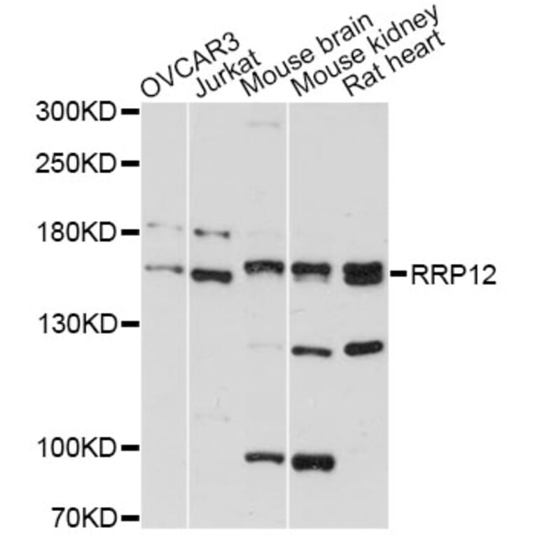 Western Blot - Anti-RRP12 Antibody (A13257) - Antibodies.com