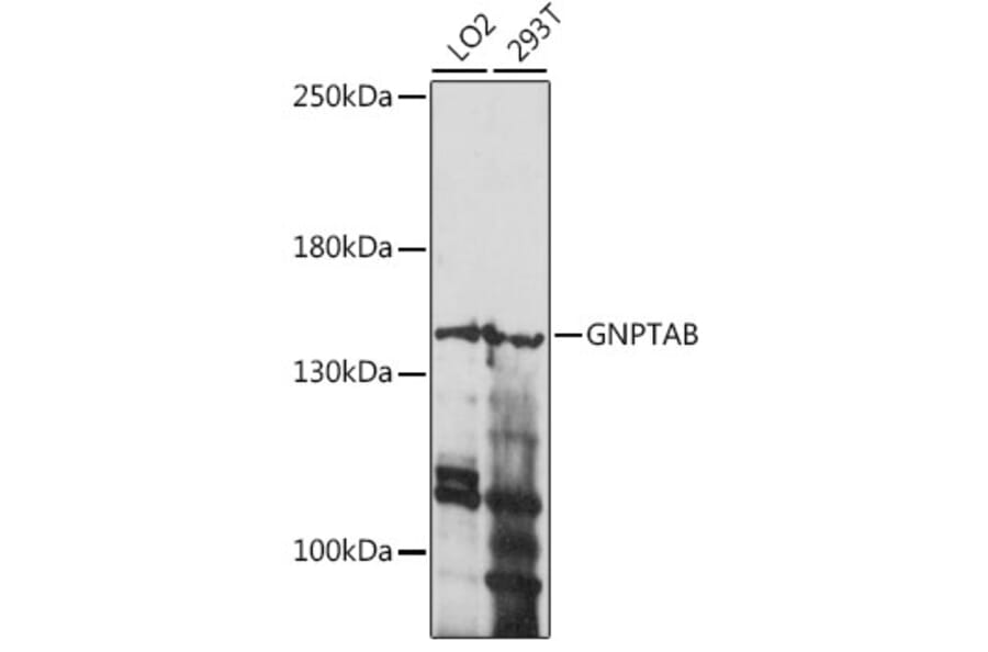 Western Blot - Anti-GNPTAB Antibody (A88257) - Antibodies.com
