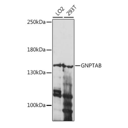 Western Blot - Anti-GNPTAB Antibody (A88257) - Antibodies.com