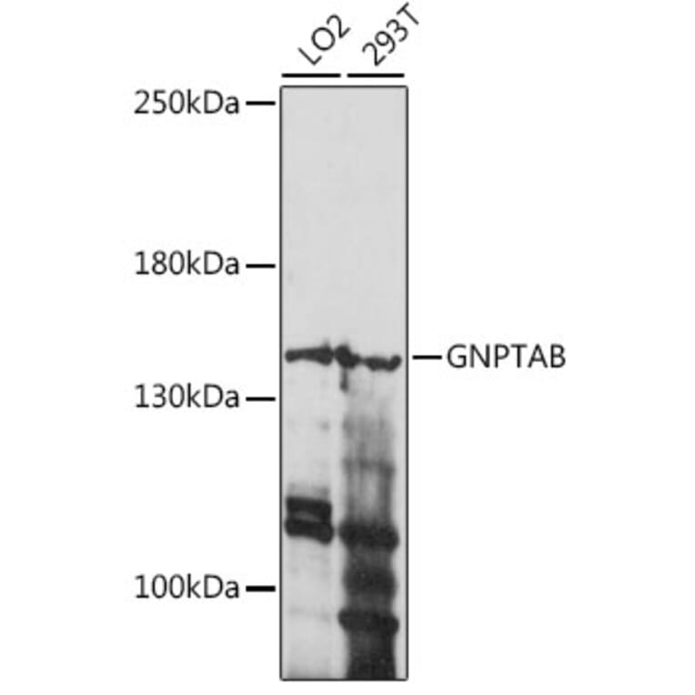 Western Blot - Anti-GNPTAB Antibody (A88257) - Antibodies.com