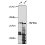 Western Blot - Anti-GNPTAB Antibody (A88257) - Antibodies.com