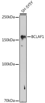 Western blot analysis of extracts of various cell lines, using Anti-BCLAF1 Antibody (A16473) at 1:1,000 dilution.
Secondary antibody: Goat Anti-Rabbit IgG (H+L) (HRP) (AS014) at 1:10,000 dilution.
Lysates / proteins: 25µg per lane.
Blocking buffer: 3% non-fat dry milk in TBST.
Detection: ECL Enhanced Kit (RM00021).
Exposure time: 90s.