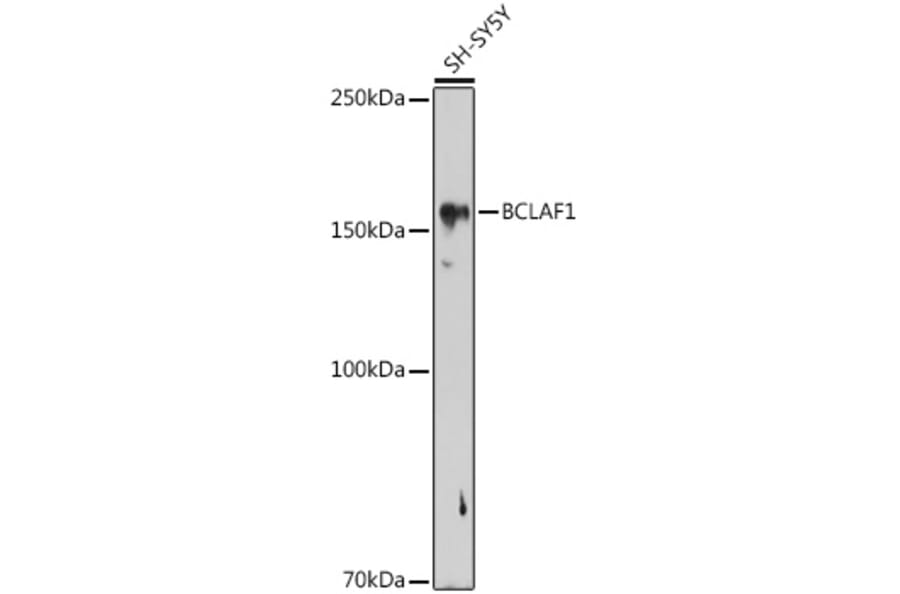 Western Blot - Anti-BTF Antibody (A88259) - Antibodies.com