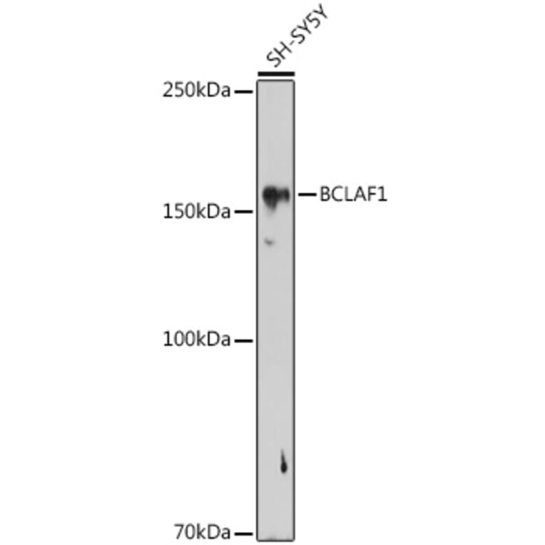 Western Blot - Anti-BTF Antibody (A88259) - Antibodies.com