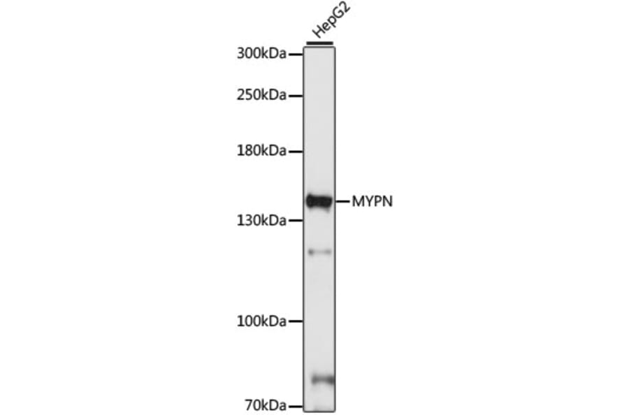 Western Blot - Anti-MYPN Antibody (A88260) - Antibodies.com