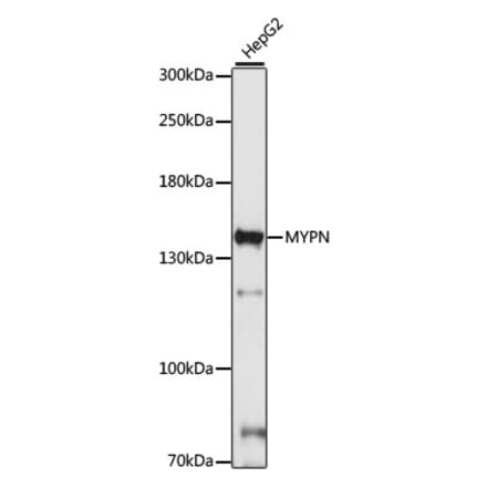 Western Blot - Anti-MYPN Antibody (A88260) - Antibodies.com