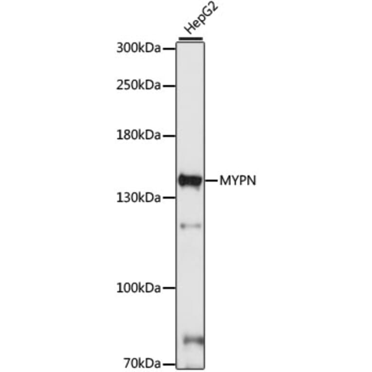 Western Blot - Anti-MYPN Antibody (A88260) - Antibodies.com