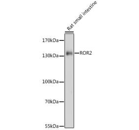 Western Blot - Anti-ROR2 Antibody (A88261) - Antibodies.com